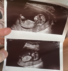 Can someone please help with gender prediction