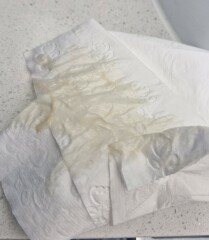 Mucous plug?