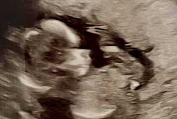 15+3 gender guesses