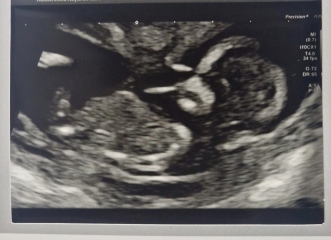 Can you tell the gender?