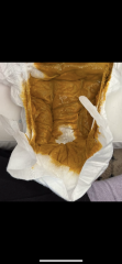 EBF nappy or allergy? Poo pics