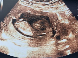 Guesses for sex of baby please
