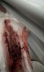 Is this miscarriage?