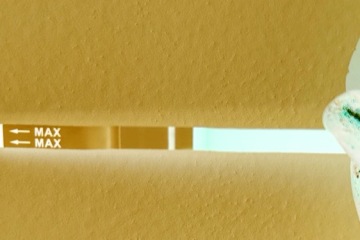 vvvfl or line eyes? 11DPO and losing it