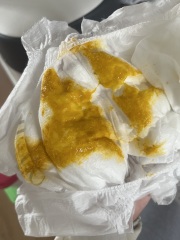 Mucus in baby poo? *pictures*