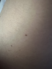 Moles