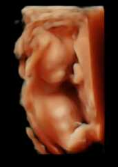 Due in September - over 40 :)