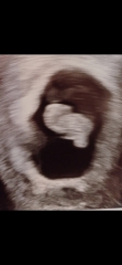 8 week scan query