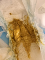 Baby Poo - is this normal?! **trigger warning - pic attached**
