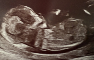 Guess twin gender