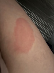 March 2025 Starters thread 4