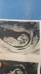 Girl or boy 12 weeks 3 days