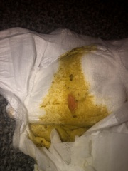 Orange/red clot-like thing in baby’s nappy