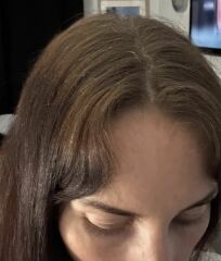 Should I continue growing out colour