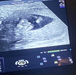 Potty shot - is this a boy?