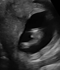 Potty shot - is this a boy?