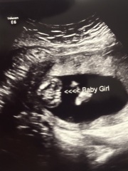 Potty gender scan