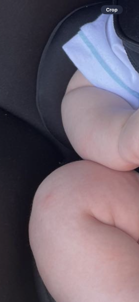 Really anxious. What is this? 13 week old. Spots on body