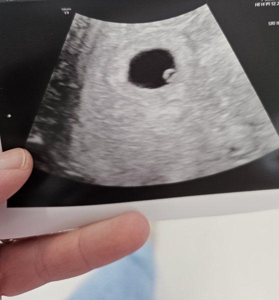 TTC May 2023 💖 Previous MC March 2023 (thread 5)