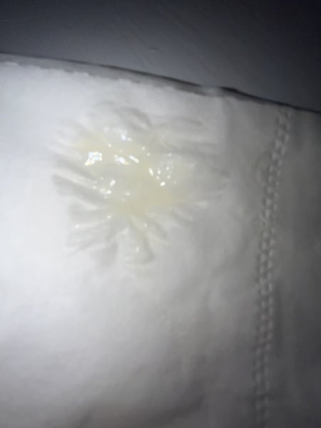 Very light coloured discharge- 7weeks+5 days pregnant. HELP