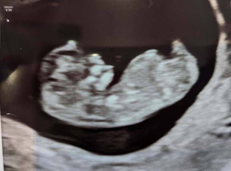 Due December 2025