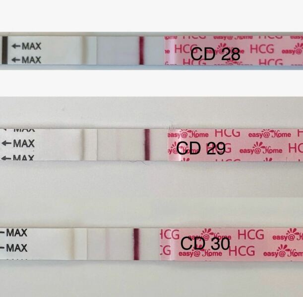 Have I got line eyes??