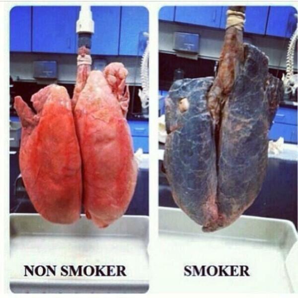 To wonder if people were actually healthier when everyone smoked