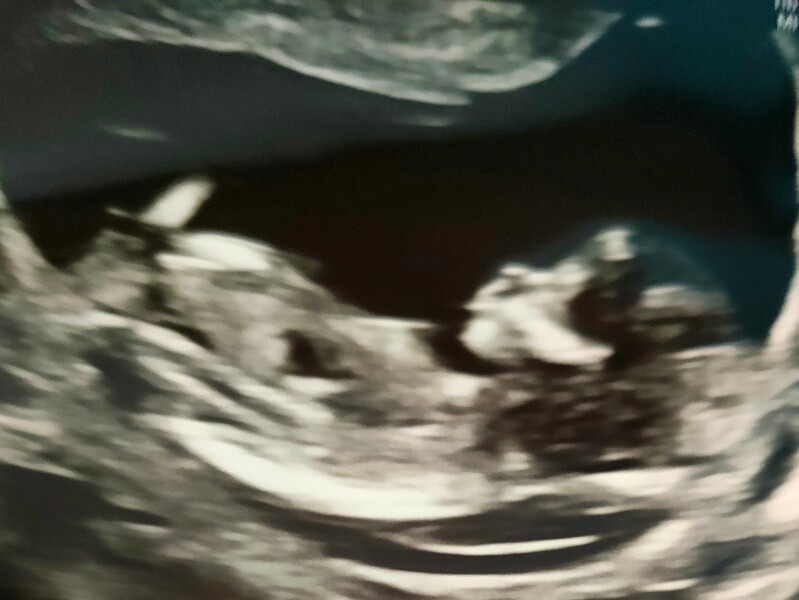 Due December 2025