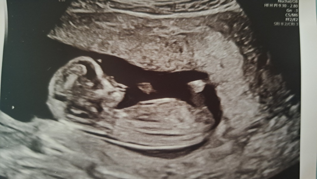 Due December 2025