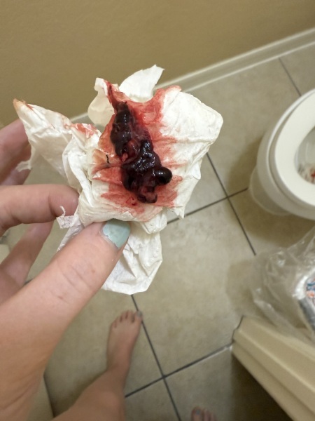 Is this a miscarriage??