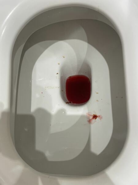 Toilet full of blood (pic ⚠️)