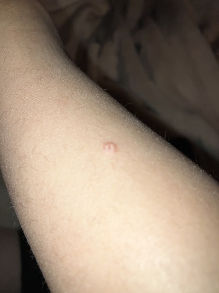 What are these spots?