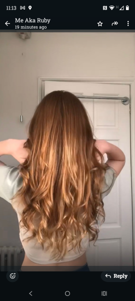 DD17 hair is really thinning and getting her down.
