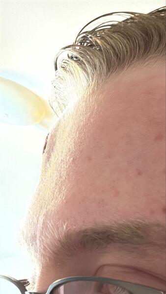 Does this need A&E ?