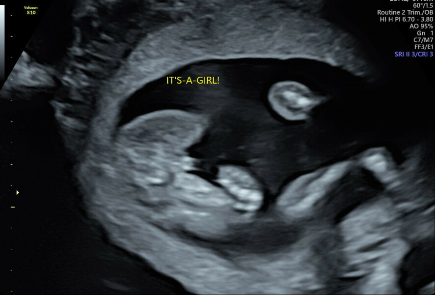 Gender Potty shot doubts? 16+1 weeks