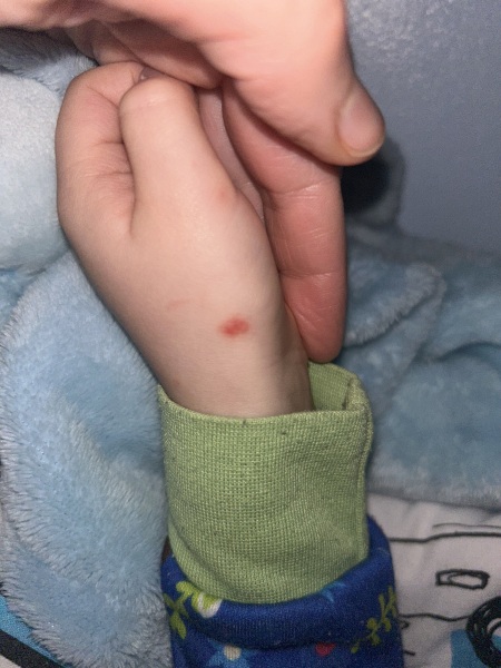 Weird spots 4 year old