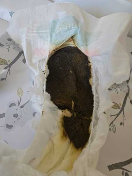 A poo of concern? Pic attached (be warned, it's a poo pic)