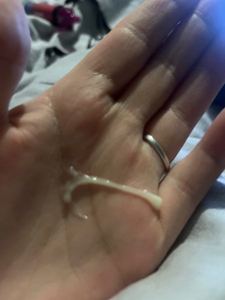 5 weeks pregnant with this discharge this this normal?