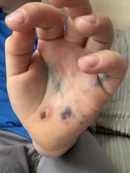 Does this look infected?