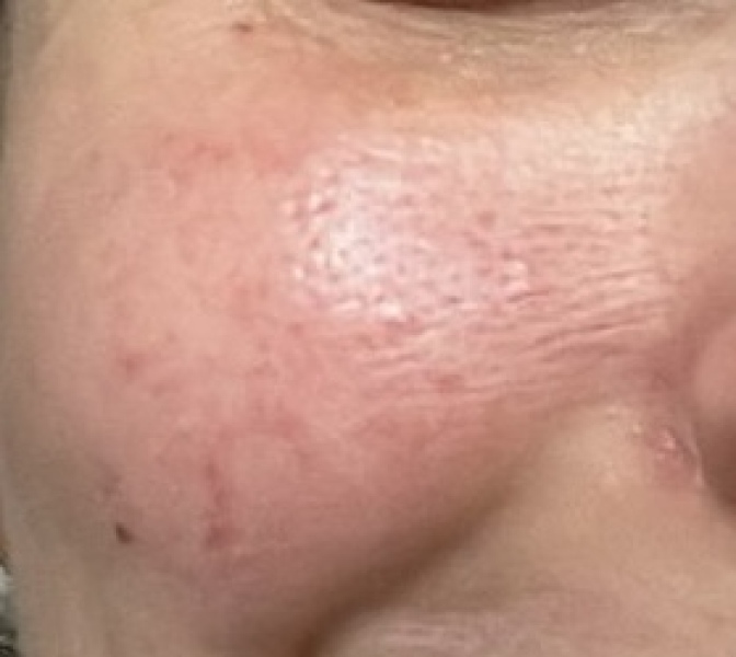 Skincare recommendations (pics!)