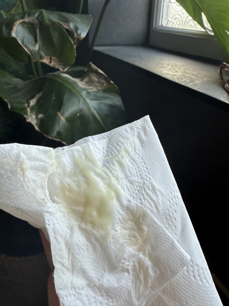Is this my mucus plug & potentially my waters? Preterm test came back positive