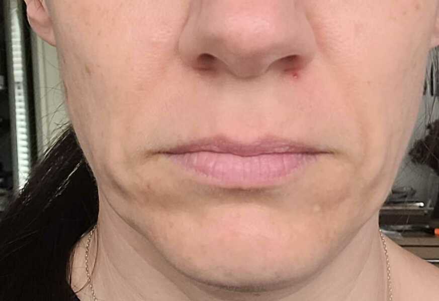 Saggy mouth and jaw help needed (pic attached)