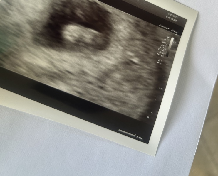 Due January 2026 ✨