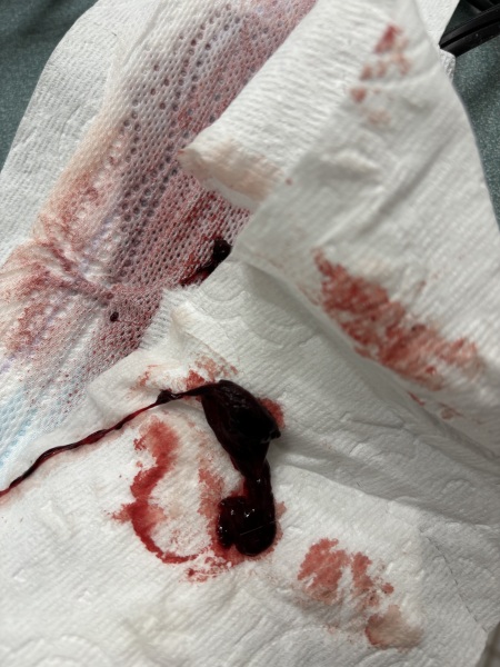 Got this after ovulated