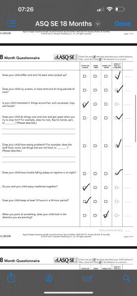 18 month old development delay?