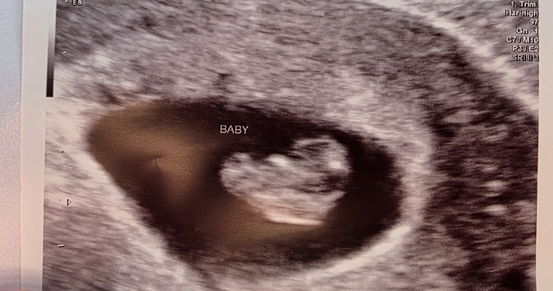 Due December 2025
