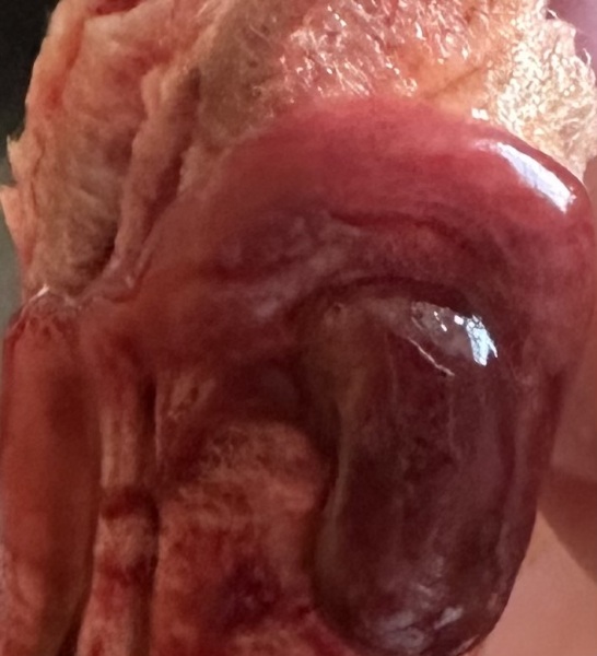 Possible miscarriage? 6 weeks 4 days