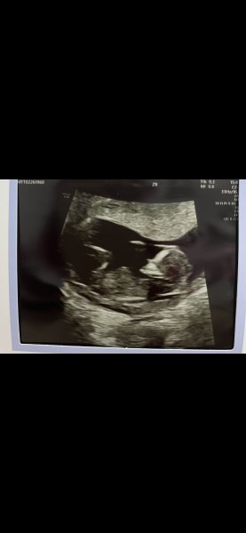 Boy or girl?