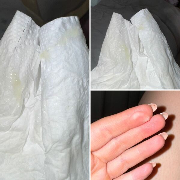 Is this my mucus plug?!