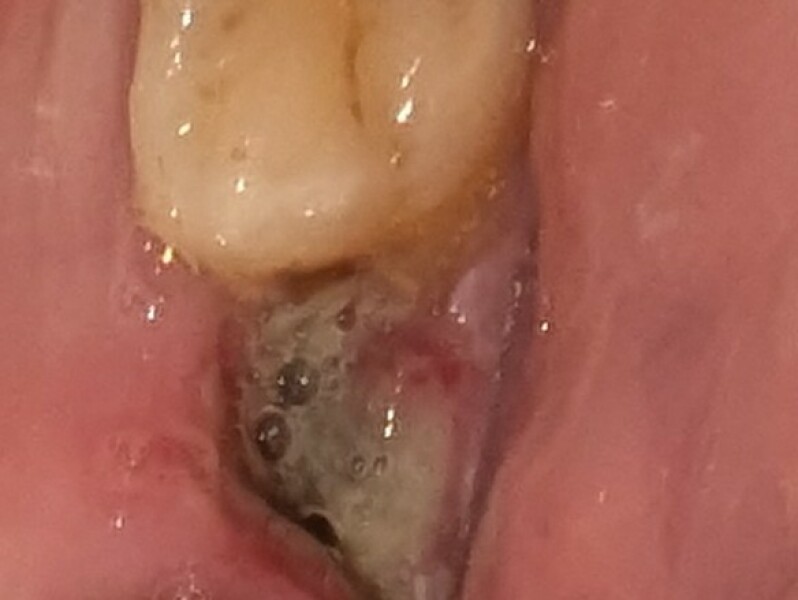 Any dentists about-need advice